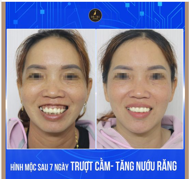 HÌNH MỘC CHỊ KHÁCH THẤY RÕ KHÁC BIỆT