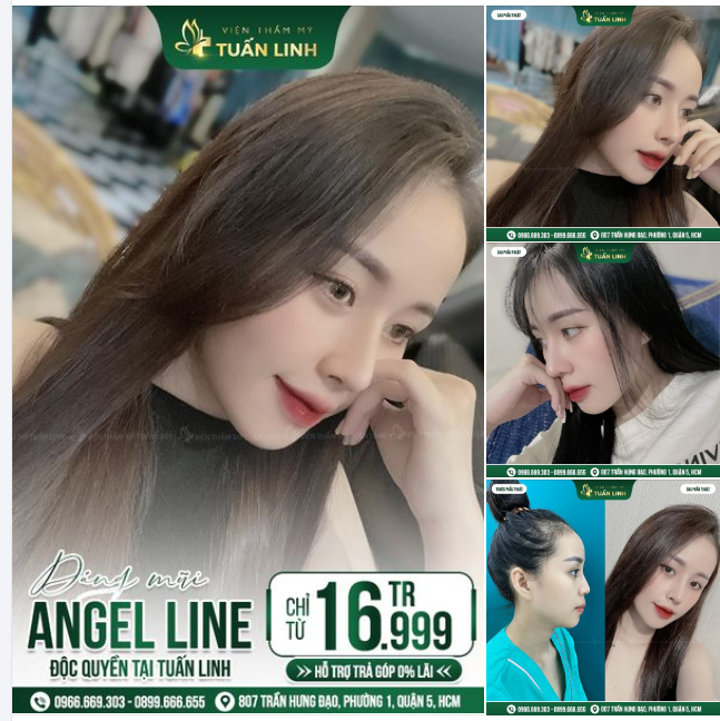 Dáng Angel Line độc quyền tại Tuấn Linh giá chỉ từ 16tr999