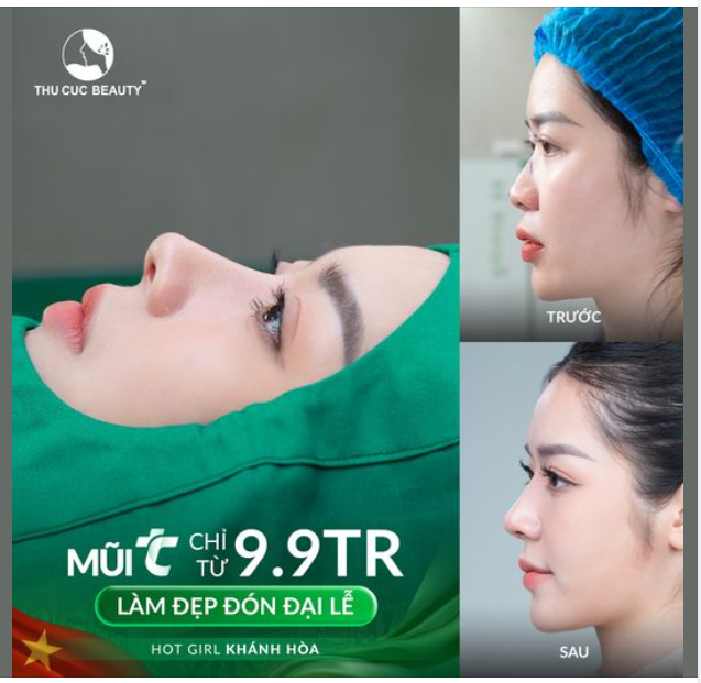Thời điểm "vàng" để nâng cấp visual với giá ưu đãi  Mũi TC từ 9.9TR