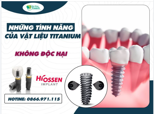 TẠI SAO TITANIUM LẠI ĐƯỢC DÙNG TRONG NHA KHOA - KHÔNG ĐỘC HẠI