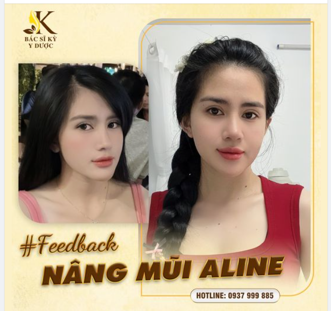 CHUYÊN MỤC FEEDBACK MŨI XINH