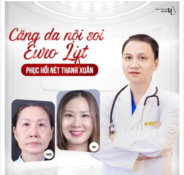 CĂNG DA NỘI SOI EURO LIFT - PHỤC HỒI NÉT THANH XUÂN