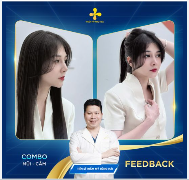 Combo nâng mũi - độn cằm sau nhiều năm thực hiện của chị đẹp Thu Thủy.