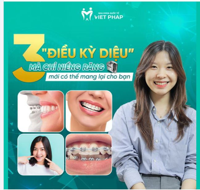 3 "ĐIỀU KỲ DIỆU" MÀ CHỈ NIỀNG RĂNG MỚI CÓ THỂ MANG LẠI CHO BẠN