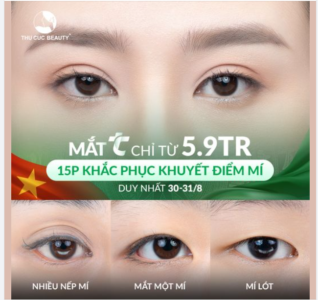 Mí nét - Mắt xinh đón Đại lễ với chi phí cực hời chỉ từ 5.9Tr  Miễn phí trải nghiệm làm đẹp cao cấp