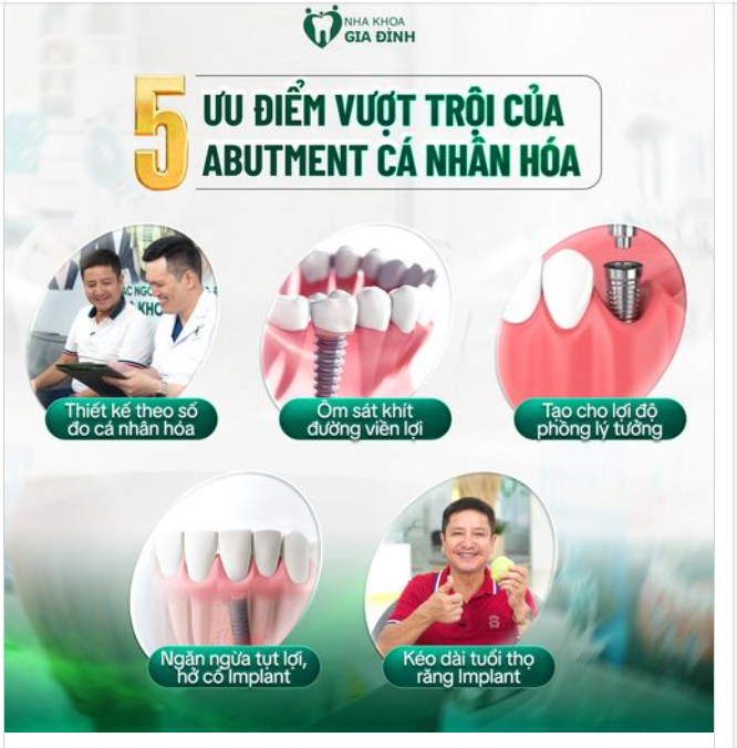 5 ƯU ĐIỂM VƯỢT TRỘI CỦA ABUTMENT CÁ NHÂN HÓA