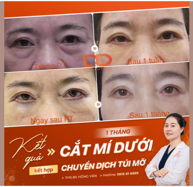 Có một sự khác biệt lớn nhưng thật khó để nhận ra dấu vết phẫu thuật