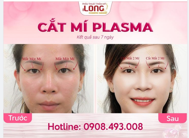 GỠ BỎ “PHONG ẤN” Nhan sắc thêm xinh khi biết cách sử dụng