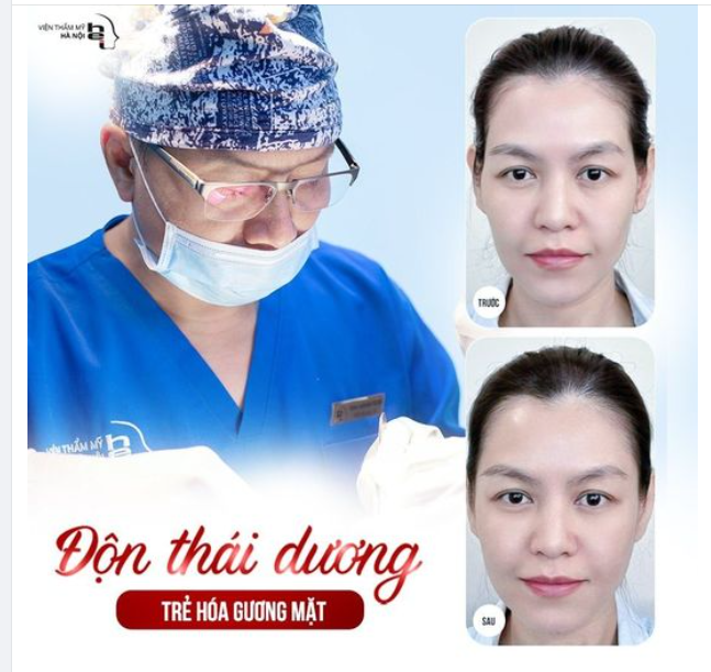 ĐỘN THÁI DƯƠNG - TRẺ HOÁ GƯƠNG MẶT