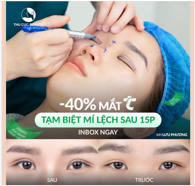 Mắt TC giảm 40% - Cơ hội duy nhất trong tháng 8 này