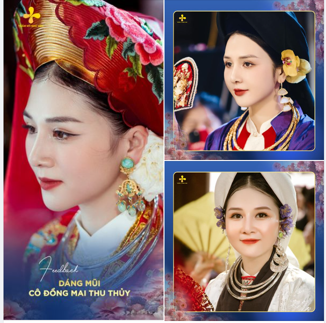 NGẮM GÓC NGHIÊNG NHÌN LÀ MUỐN NÂNG MŨI CỦA CÔ ĐỒNG THU THỦY