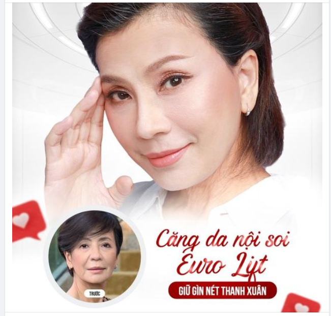 CĂNG DA NỘI SOI EURO LIFT - GIỮ GÌN NÉT THANH XUÂN