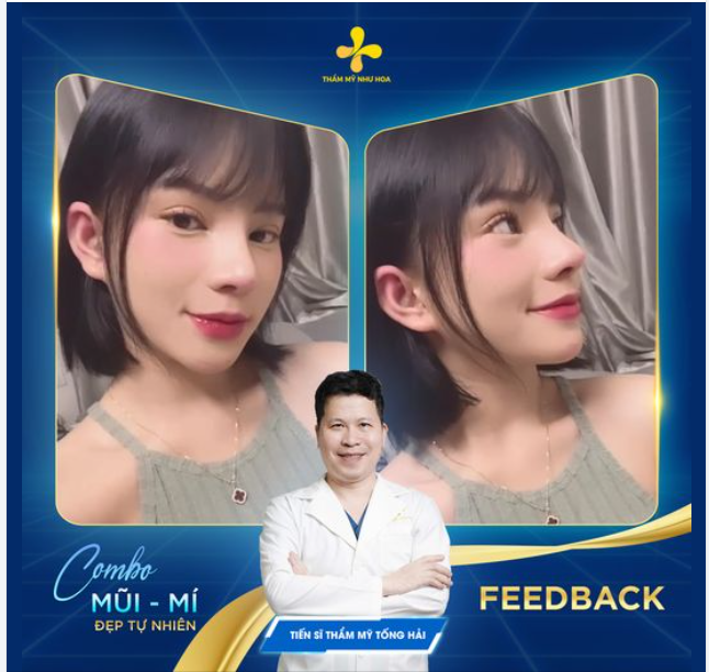 Flexing combo Mũi – Mí chuẩn tỉ lệ vàng của CHỊ ĐẸP 2006