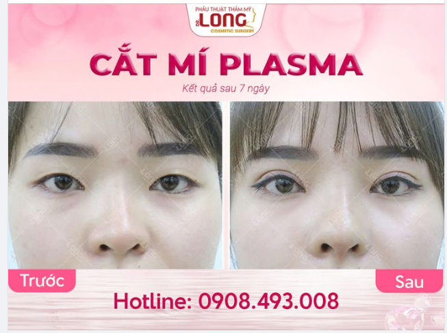 8-8 SIÊU SALE ĐẬM SÂU Để càng lâu làm sao có thể ĐẸP khi chưa giải quyết tình trạng về MẮT