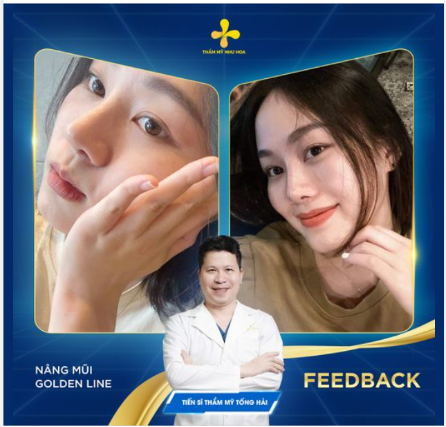 Flexing nhẹ dáng mũi 7 tháng tuổi của chị đẹp Ngân 