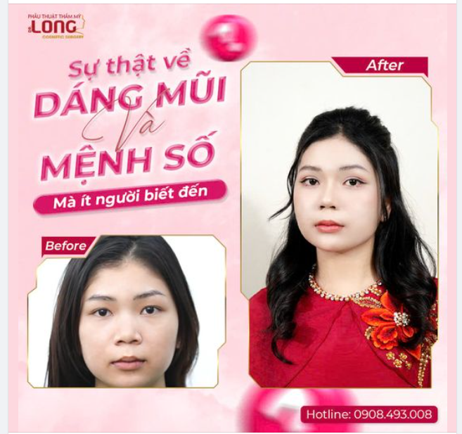 SỰ THẬT VỀ DÁNG MŨI VÀ MỆNH SỐ, ÍT AI BIẾT !!!
