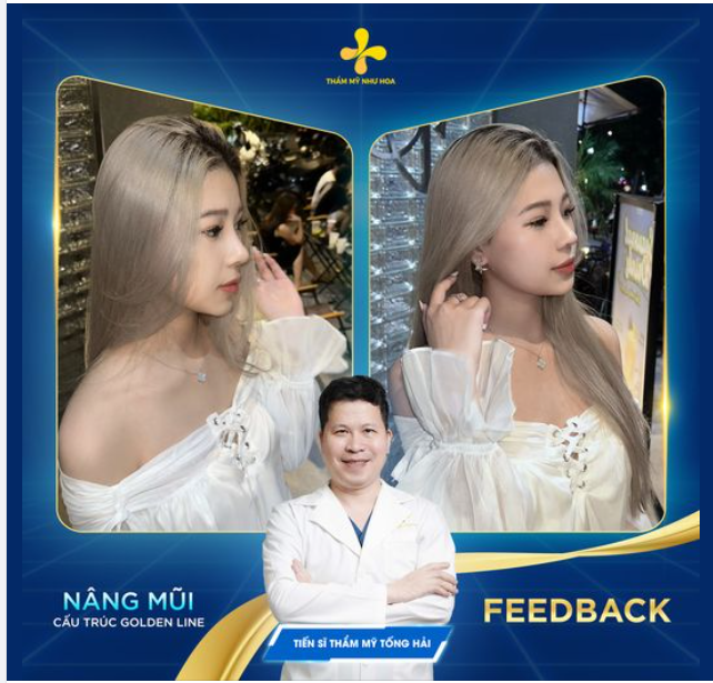 CẢM ƠN CHỊ ĐẸP KHÁNH VY ĐÃ GỬI FEEDBACK SAU 1 THÁNG NÂNG MŨI CẤU TRÚC GOLDEN LINE 