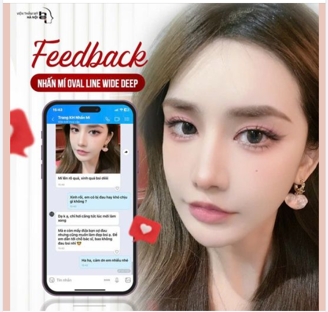 Feedback đến từ một cô nàng sợ đau nhưng khi đã Nhấn mí xong thì hối hận "không làm đẹp sớm hơn" vì CHẲNG ĐAU CHÚT NÀO