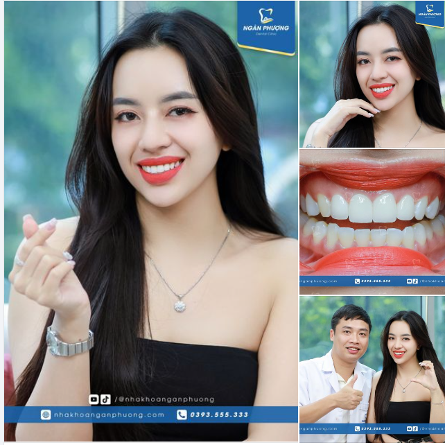 Nụ cười đẹp nhất là nụ cười phù hợp với khuôn mặt