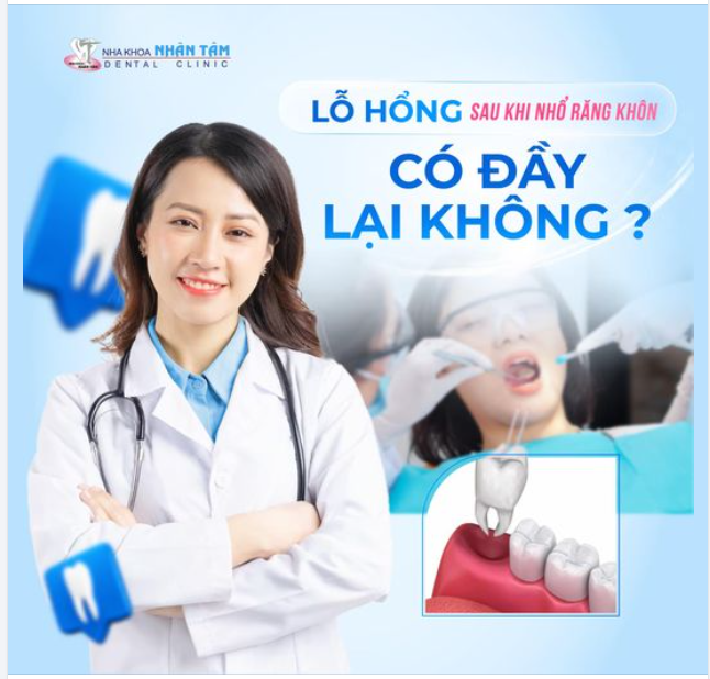Lỗ Hổng Sau Khi Nhổ Răng Khôn Có Đầy Lại Không?