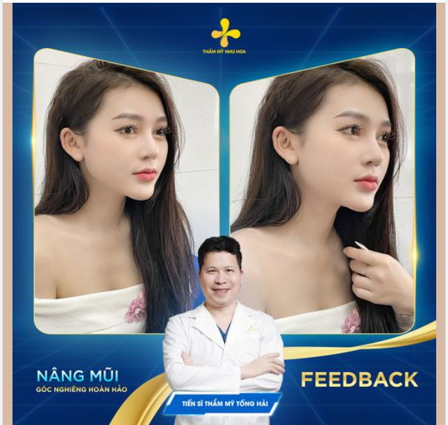 Ngắm nhìn nhan sắc cực phẩm của chị đẹp Thu Huệ sau 6 tháng nâng mũi tại Thẩm mỹ Như Hoa