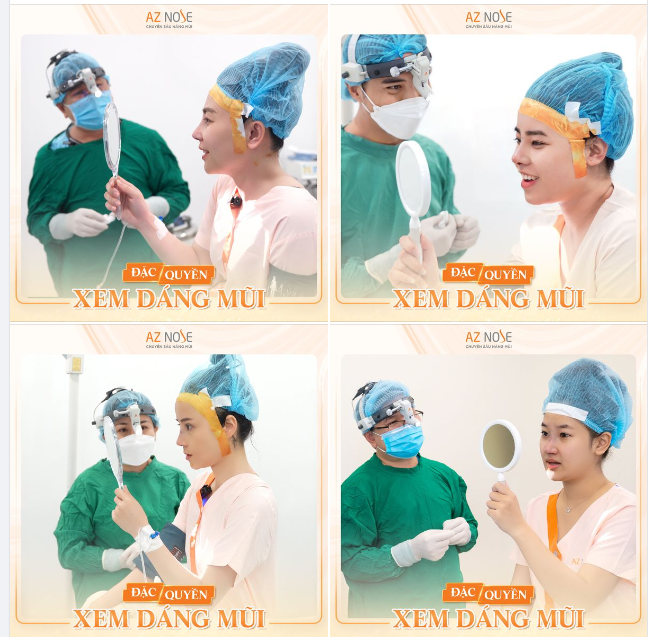 Khoảnh khắc hạnh phúc với dáng mũi mới