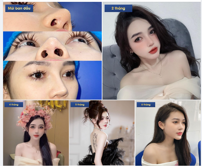 Ngắm nhìn nhan sắc cực phẩm của chị đẹp Thu Huệ sau 6 tháng nâng mũi tại Thẩm mỹ Như Hoa 