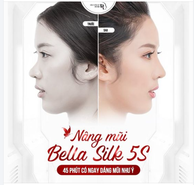 NÂNG MŨI BELLA SILK 5S 45 phút có ngay MŨI XINH NHƯ Ý
