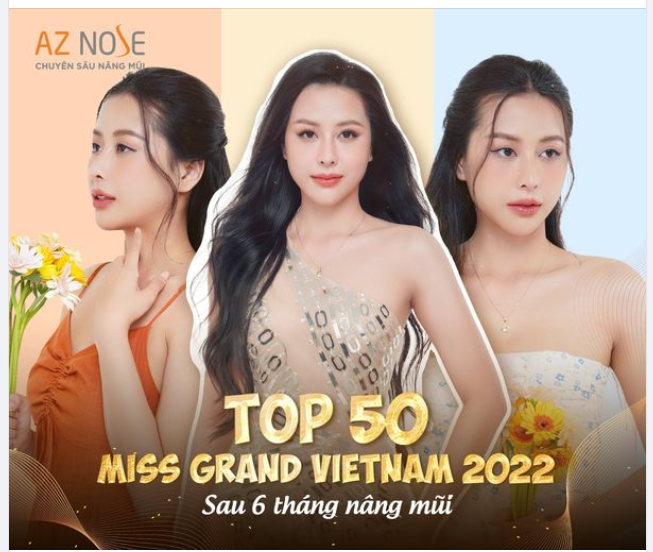 Top 50 MGV thần thái với dáng mũi 6 tháng tuổi
