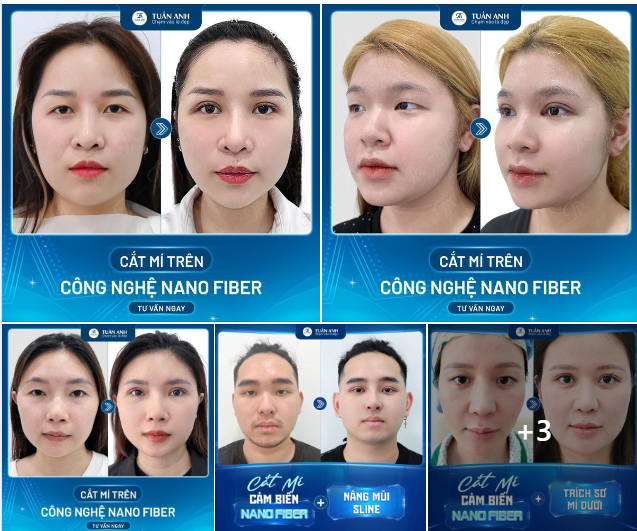 KIẾN TẠO NẾP MÍ TO TRÒN TỰ NHIÊN - CÔNG NGHỆ NANO FIBER