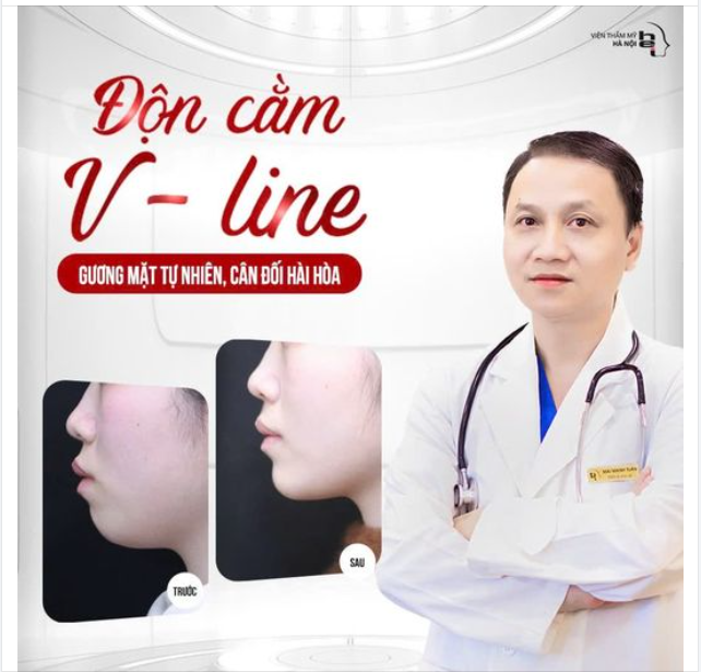 ĐỘN CẰM VLINE GÓC NGHIÊNG THÊM ĐẸP