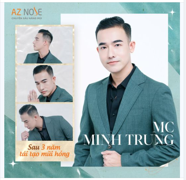 Bén duyên với nghề "cầm mic", trở thành Giám đốc Công ty Giải trí sau 3 năm tái tạo mũi h.ỏng