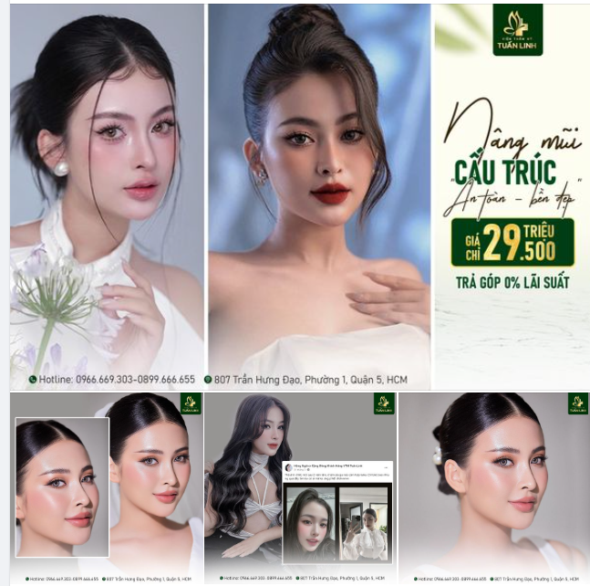 NÂNG MŨI Ở TUẤN LINH XONG PHIỀN LẮM CHỊ ƠI !!