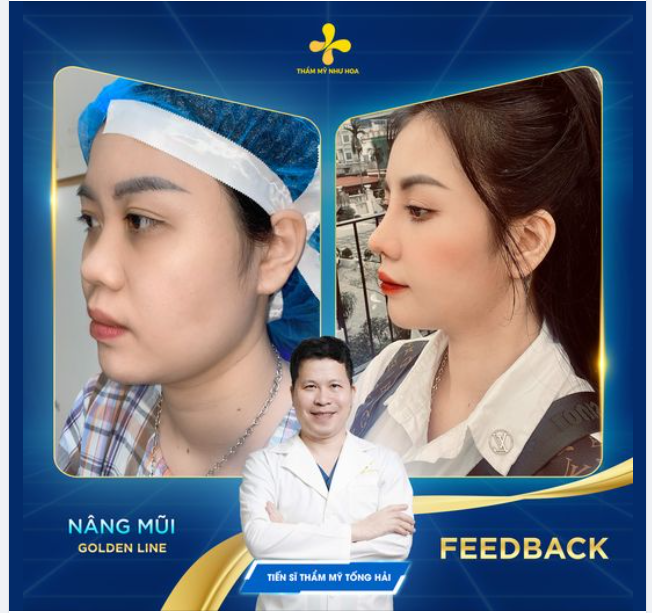 TOP NHỮNG CÁCH GIÚP CHỊ ĐẸP TRÔNG TRẺ HƠN
