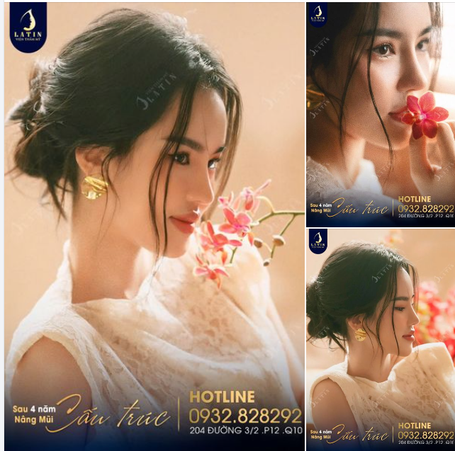 Dáng mũi mới - Nhan sắc rạng ngời