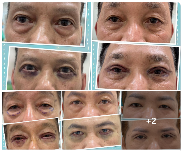Ai bảo nam giới không được làm đẹp. Làm đẹp ngày nay không chỉ về mặt thẩm mỹ mà hơn hết là về chất lượng cuộc sống.