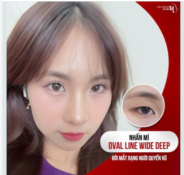 NHẤN MÍ OVAL LINE WIDE DEEP