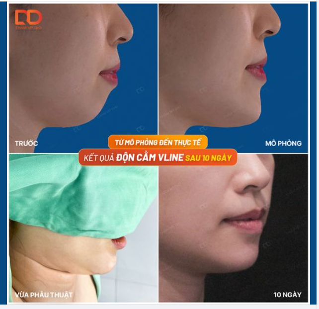 CẰM HẾT LẸM, MIỆNG ĐỠ HÔ CHỈ SAU 45 PHÚT ĐỘN CẰM.