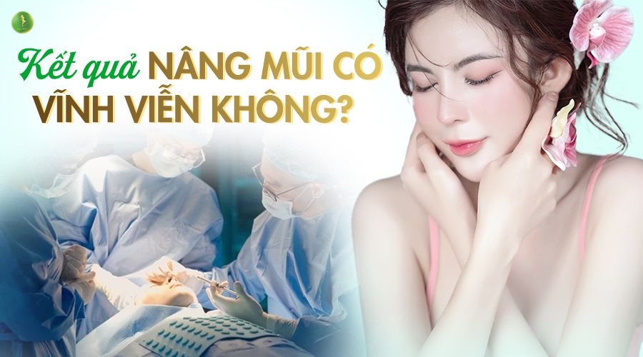 KẾT QUẢ NÂNG MŨI CÓ DUY TRÌ VĨNH VIỄN ĐƯỢC KHÔNG?