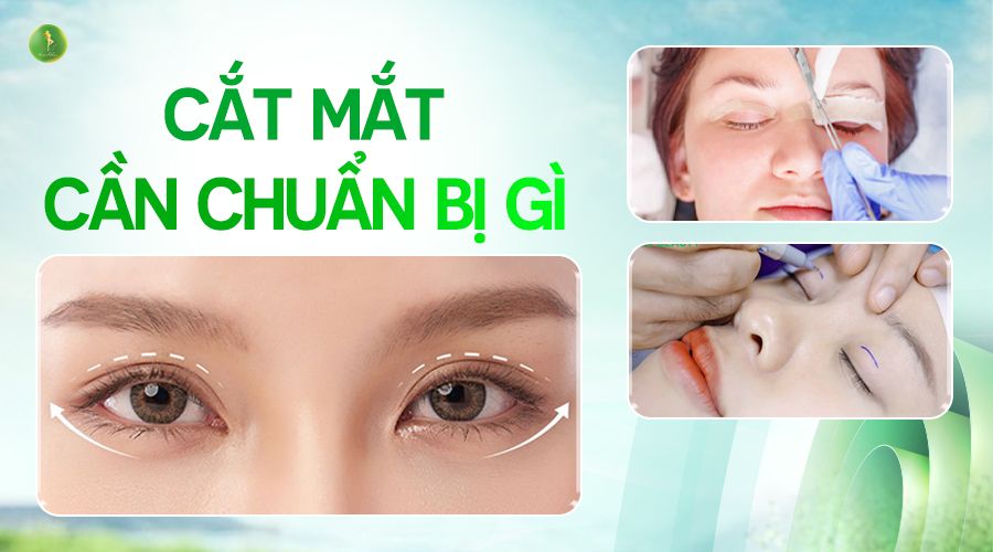 CẦN CHUẨN BỊ GÌ TRƯỚC KHI CẮT MÍ?