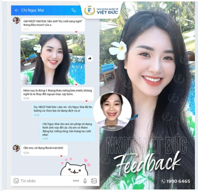 NIỀNG RĂNG ĐÃ GIÚP BẠN THAY ĐỔI NHƯ THẾ NÀO?