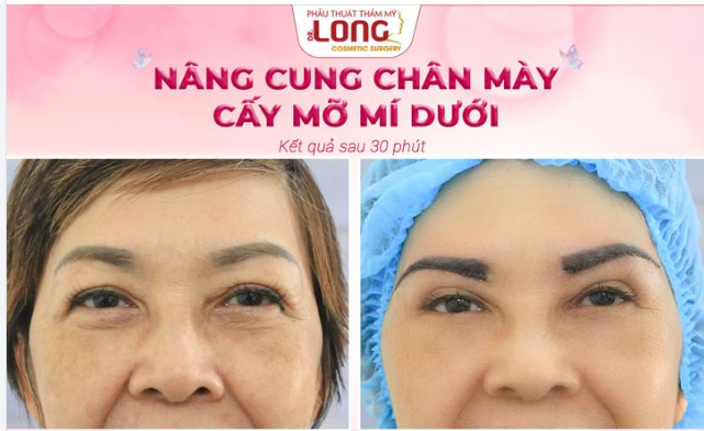 CUỐI TUẦN VUI VẺ LÀM ĐẸP LÀ THẤY “TRẺ” RA