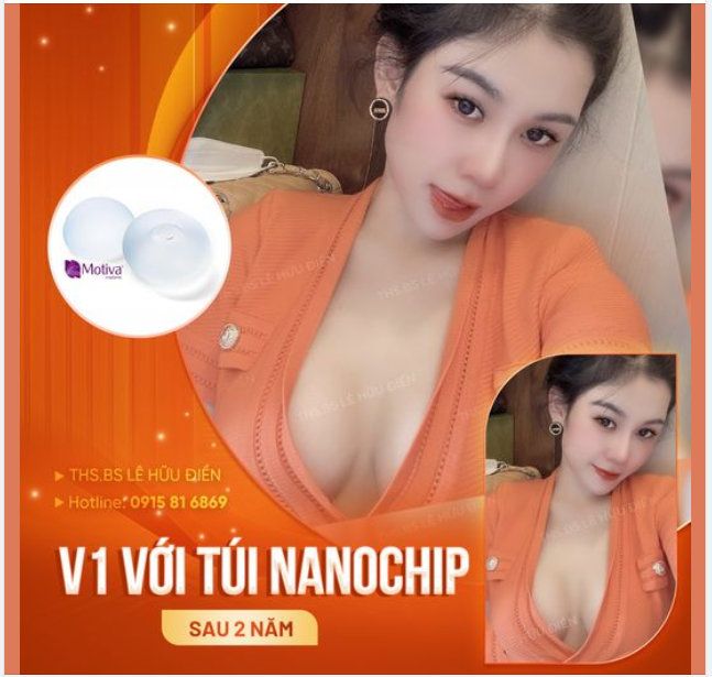 GÓC FEEDBACK KHÁCH HÀNG VÔ CÙNG ƯNG Ý SAU 2 NĂM NÂNG CẤP V1 TÚI NANOCHIP.