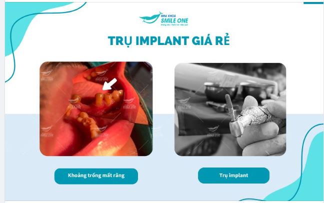 Ham trồng răng implant giá rẻ và những biến chứng khôn lường mà người bệnh phải đối mặt