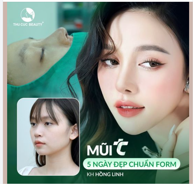 Tưng bừng làm đẹp mừng Đại lễ - Nâng mũi chỉ từ 9.9Tr duy nhất 30-31/8