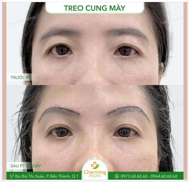 Phần cung mày thấp khiến cả gương mặt của nàng khách trông lờ đờ, thiếu sức sống. Và đó là lí do nàng quyết định đến Charming thực hiện treo cung mày.