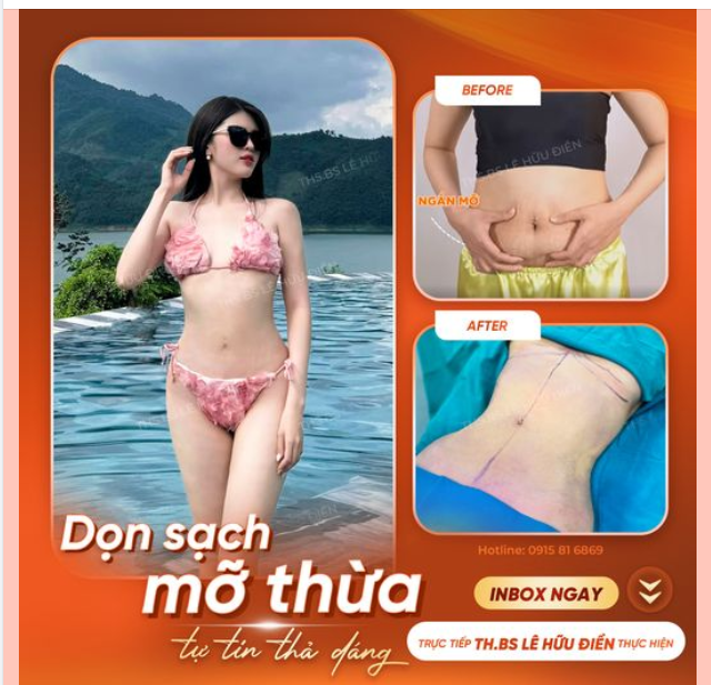 DỌN SẠCH MỠ THỪA TỰ TIN THẢ DÁNG.