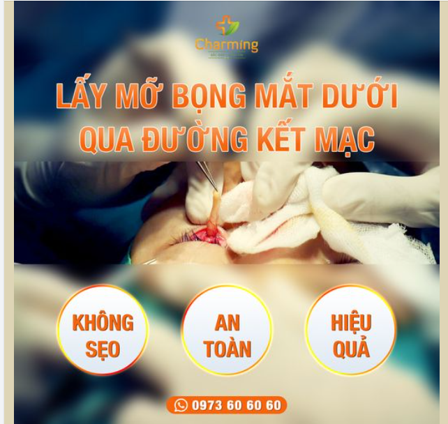 LẤY BỌNG MỠ MÍ DƯỚI - PHƯƠNG PHÁP GIÚP ĐÔI MẮT TRẺ TRUNG, TƯƠI TẮN