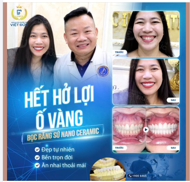AI RỒI CŨNG KHÁC SAU KHI BỌC RĂNG SỨ TẠI NKQT VIỆT ĐỨC DR. MẬU