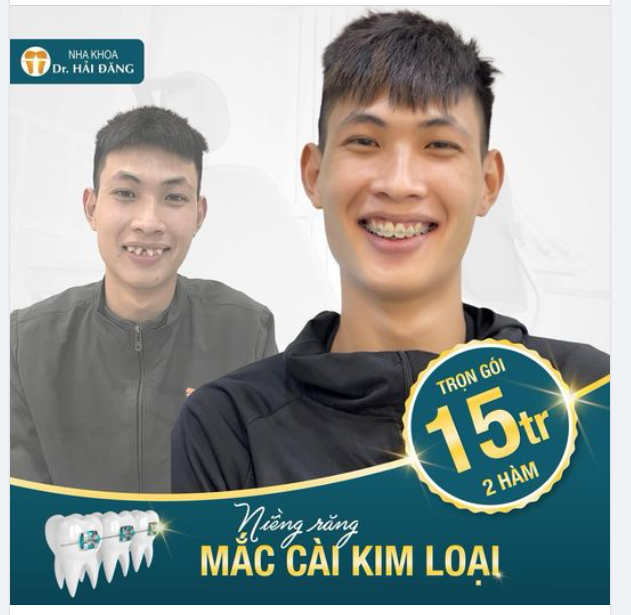NẾU KHÔNG THAY ĐỔI CẢ THẾ GIỚI - THÌ HÃY THAY ĐỔI NỤ CƯỜI CỦA CHÍNH MÌNH